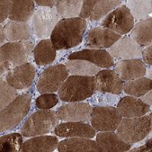 Anti-PHKA1 antibody produced in rabbit Prestige Antibodies® Powered by Atlas Antibodies, affinity isolated antibody, buffered aqueous glycerol solution