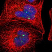 Anti-ACTN4 antibody produced in rabbit Prestige Antibodies® Powered by Atlas Antibodies, affinity isolated antibody, buffered aqueous glycerol solution