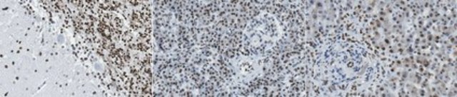 Anti-Thyroid Hormone Receptor &#946;-1 Antibody, clone N402/46 clone N402/46, from mouse