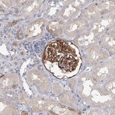 Anti-EPB41L5 antibody produced in rabbit Prestige Antibodies® Powered by Atlas Antibodies, affinity isolated antibody, buffered aqueous glycerol solution