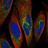 Anti-OSBPL9 antibody produced in rabbit Prestige Antibodies® Powered by Atlas Antibodies, affinity isolated antibody, buffered aqueous glycerol solution, Ab2