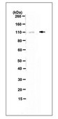 Anti-Alanyl-tRNA synthetase (AARS Antibody), clone M6-P2E5 clone P2E5, 1 mg/mL, from mouse