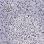 Anti-ITIH4 antibody produced in rabbit Ab1, Prestige Antibodies® Powered by Atlas Antibodies, affinity isolated antibody, buffered aqueous glycerol solution