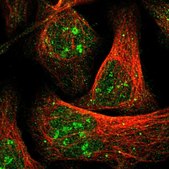 Anti-ZBTB37 antibody produced in rabbit Prestige Antibodies® Powered by Atlas Antibodies, affinity isolated antibody, buffered aqueous glycerol solution