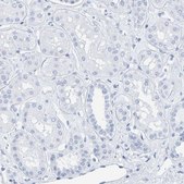 Anti-SFTPC antibody produced in rabbit Prestige Antibodies® Powered by Atlas Antibodies, affinity isolated antibody, buffered aqueous glycerol solution, Ab1