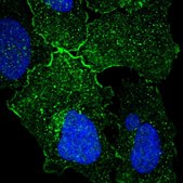 Anti-GPR156 antibody produced in rabbit Prestige Antibodies® Powered by Atlas Antibodies, affinity isolated antibody, buffered aqueous glycerol solution, ab2