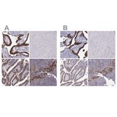 Anti-ERO1A antibody produced in rabbit Prestige Antibodies® Powered by Atlas Antibodies, affinity isolated antibody, buffered aqueous glycerol solution