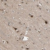 Anti-TRIO antibody produced in rabbit Prestige Antibodies® Powered by Atlas Antibodies, affinity isolated antibody, buffered aqueous glycerol solution