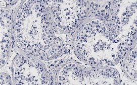Anti-COIL Antibody, clone 2K14-2 ZooMAb® Rabbit Monoclonal recombinant, expressed in HEK 293 cells