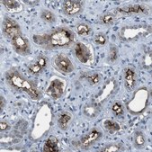 Anti-CDHR2 antibody produced in rabbit Prestige Antibodies® Powered by Atlas Antibodies, affinity isolated antibody, buffered aqueous glycerol solution