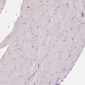 Anti-XAGE2 antibody produced in rabbit Prestige Antibodies® Powered by Atlas Antibodies, affinity isolated antibody, buffered aqueous glycerol solution
