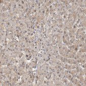Anti-AK9 antibody produced in rabbit Prestige Antibodies® Powered by Atlas Antibodies, affinity isolated antibody, buffered aqueous glycerol solution