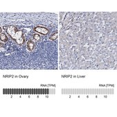 Anti-NRIP2 antibody produced in rabbit Prestige Antibodies® Powered by Atlas Antibodies, affinity isolated antibody, buffered aqueous glycerol solution