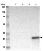 Anti-GSTA1 antibody produced in rabbit Prestige Antibodies® Powered by Atlas Antibodies, affinity isolated antibody, buffered aqueous glycerol solution