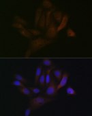 Anti-BAP31 antibody produced in rabbit