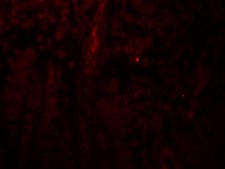 Anti-PACS1 antibody produced in rabbit affinity isolated antibody