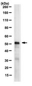 Anti-Pax-8 Antibody, clone 15C8.1 clone 15C8.1, from mouse