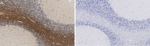 Anti-Bin1 Antibody, clone 99D.2 ZooMAb® Mouse Monoclonal recombinant, expressed in HEK 293 cells