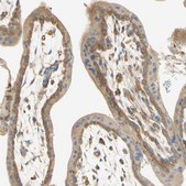 Anti-IKBKG antibody produced in rabbit Prestige Antibodies® Powered by Atlas Antibodies, affinity isolated antibody, buffered aqueous glycerol solution