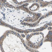 Anti-B4GALT1 antibody produced in rabbit Ab1, Prestige Antibodies® Powered by Atlas Antibodies, affinity isolated antibody, buffered aqueous glycerol solution