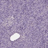 Anti-CADM4 antibody produced in rabbit affinity isolated antibody, buffered aqueous glycerol solution