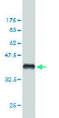 ANTI-FHIT antibody produced in mouse clone 1H2, purified immunoglobulin, buffered aqueous solution