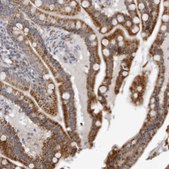 Anti-CPT2 antibody produced in rabbit Prestige Antibodies® Powered by Atlas Antibodies, affinity isolated antibody, buffered aqueous glycerol solution, ab1