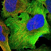 Anti-TRMT1 antibody produced in rabbit Prestige Antibodies® Powered by Atlas Antibodies, affinity isolated antibody, buffered aqueous glycerol solution