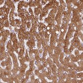 Anti-HSD11B1 antibody produced in rabbit Prestige Antibodies® Powered by Atlas Antibodies, affinity isolated antibody, buffered aqueous glycerol solution