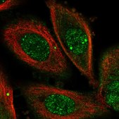 Anti-OSGEP antibody produced in rabbit Prestige Antibodies® Powered by Atlas Antibodies, affinity isolated antibody, buffered aqueous glycerol solution