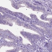 Anti-SPDYA antibody produced in rabbit Prestige Antibodies® Powered by Atlas Antibodies, affinity isolated antibody, buffered aqueous glycerol solution