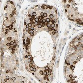 Anti-KIF11 antibody produced in rabbit affinity isolated antibody, Prestige Antibodies® Powered by Atlas Antibodies, buffered aqueous glycerol solution