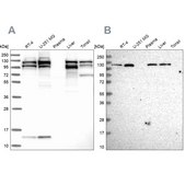 Anti-SEC24C antibody produced in rabbit Prestige Antibodies® Powered by Atlas Antibodies, affinity isolated antibody, buffered aqueous glycerol solution