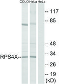 Anti-RPS4X antibody produced in rabbit affinity isolated antibody