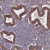 Anti-PPP2R3C antibody produced in rabbit Prestige Antibodies® Powered by Atlas Antibodies, affinity isolated antibody, buffered aqueous glycerol solution