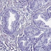 Anti-FAM166B antibody produced in rabbit Prestige Antibodies® Powered by Atlas Antibodies, affinity isolated antibody, buffered aqueous glycerol solution