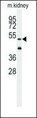 Anti-ALDH1A3 (N-term) antibody produced in rabbit saturated ammonium sulfate (SAS) precipitated, buffered aqueous solution