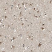 Anti-FLII antibody produced in rabbit Prestige Antibodies® Powered by Atlas Antibodies, affinity isolated antibody, buffered aqueous glycerol solution