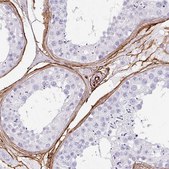 Anti-CD34 antibody produced in rabbit Prestige Antibodies® Powered by Atlas Antibodies, affinity isolated antibody, buffered aqueous glycerol solution