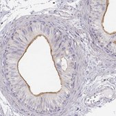 Anti-DAPL1 antibody produced in rabbit Prestige Antibodies® Powered by Atlas Antibodies, affinity isolated antibody, buffered aqueous glycerol solution