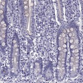 Anti-MYLPF Prestige Antibodies® Powered by Atlas Antibodies, affinity isolated antibody