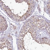 Anti-SH3TC2 antibody produced in rabbit Prestige Antibodies® Powered by Atlas Antibodies, affinity isolated antibody, buffered aqueous glycerol solution