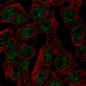 Anti-SLC5A11 antibody produced in rabbit Prestige Antibodies® Powered by Atlas Antibodies, affinity isolated antibody, buffered aqueous glycerol solution