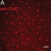 Anti-Choline Acetyltransferase Antibody Chemicon®, from goat