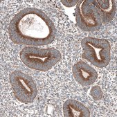 Anti-LZTR1 antibody produced in rabbit Prestige Antibodies® Powered by Atlas Antibodies, affinity isolated antibody, buffered aqueous glycerol solution
