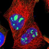Anti-LRCH2 antibody produced in rabbit Prestige Antibodies® Powered by Atlas Antibodies, affinity isolated antibody, buffered aqueous glycerol solution