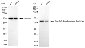 KD-Validated Anti Acyl-CoA dehydrogenase short chain Antibody, clone 23GB1365, Rabbit Monoclonal clone 23GB1365, recombinant rabbit monoclonal, expressed in HEK293 cells