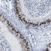 Anti-CUL4B antibody produced in rabbit Prestige Antibodies® Powered by Atlas Antibodies, affinity isolated antibody, buffered aqueous glycerol solution
