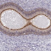Anti-ZNF185 antibody produced in rabbit Ab1, Prestige Antibodies® Powered by Atlas Antibodies, affinity isolated antibody, buffered aqueous glycerol solution