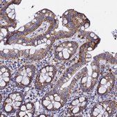Anti-PHB2 antibody produced in rabbit Prestige Antibodies® Powered by Atlas Antibodies, affinity isolated antibody, buffered aqueous glycerol solution